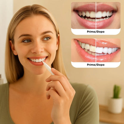 BrightSmile™ – Sbiancamento dentale ispirato ai trattamenti professionali da utilizzare a casa