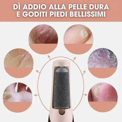 CalluCare™ – Rimuovi Calli Elettrico