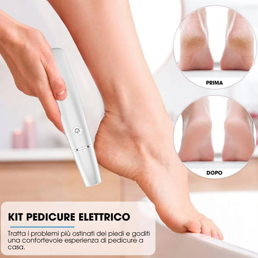 CalluCare™ – Rimuovi Calli Elettrico