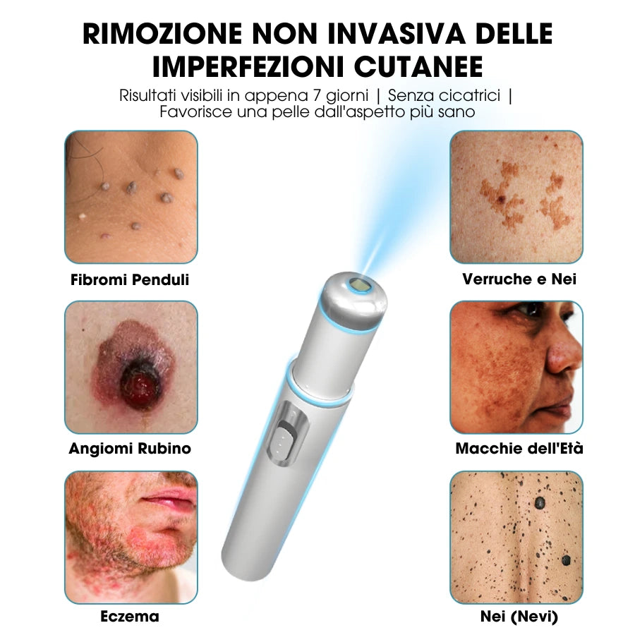 DermaLight Pro™ – Penna laser non invasiva per nei, verruche e fibromi cutanei